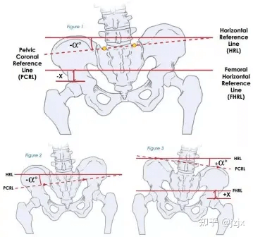 矢状面参数