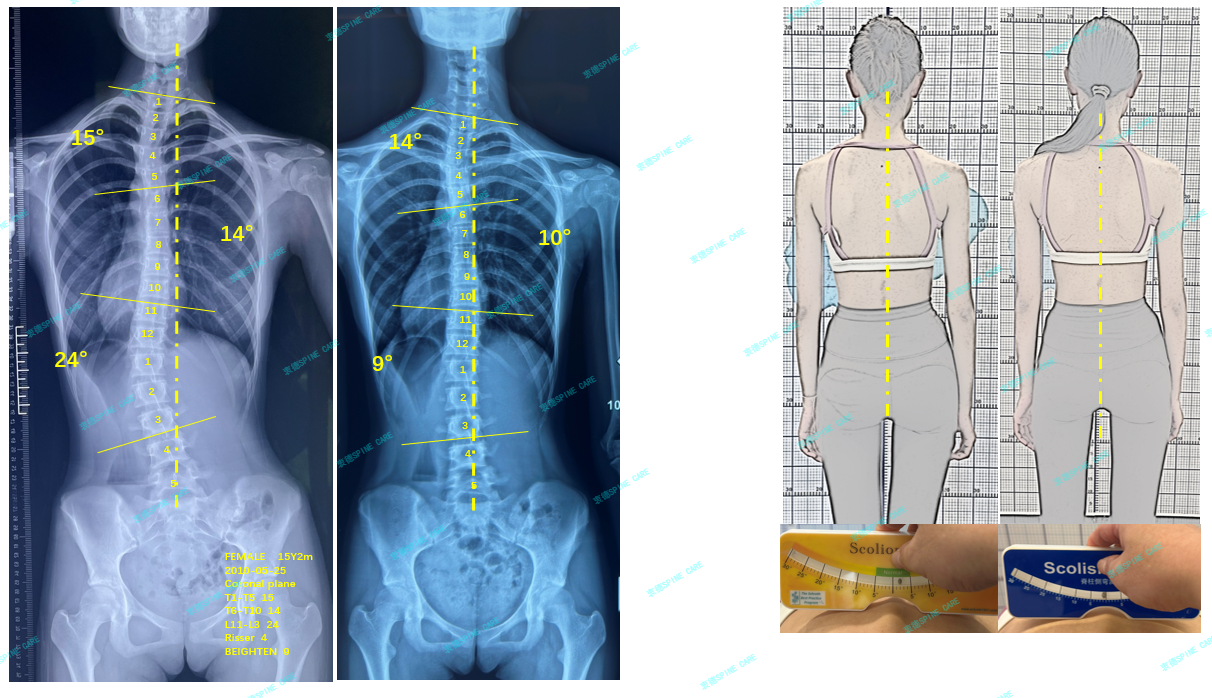 IMG_202603205617.png IMG_202603205617.png